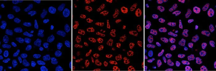 ICC/IF analysis of 4% paraformaldehyde fixed HeLa cells using GTX60803 5-Methylcytosine / 5-mC antibody [GT9076]. Red : Primary antibody Blue : DAPI Dilution : 1:1000
