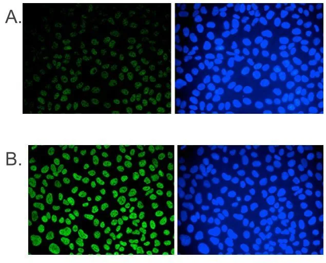 ICC/IF analysis of 2.5% PFA fixed U2OS cells using GTX60803 5-Methylcytosine / 5-mC antibody [GT9076]. Figure A : cells were immunofluorescently labelled with the 5-mC antibody after incubation of the antibody with 50 microM mCTP (left) or with DAPI (right). Figure B : staining of the cells with the 5-mC antibody after incubation of the antibody with 50 microM hmCTP and with DAPI. Dilution : 1:500