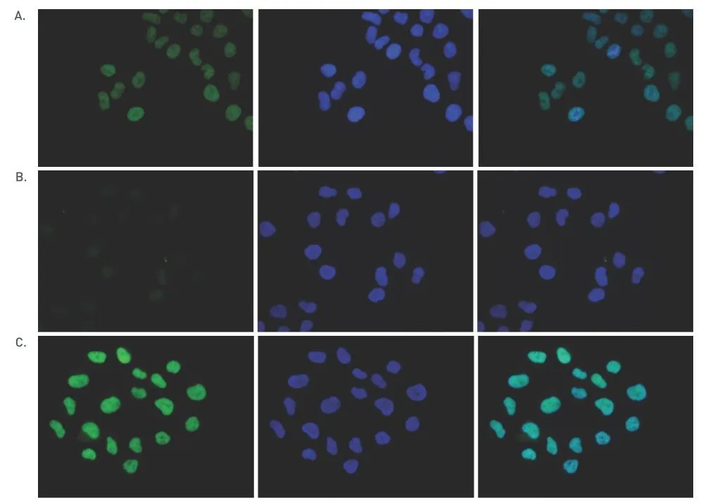 ICC/IF analysis of 4% paraformaldehyde fixed HeLa cells using GTX60812 Histone H2A.Z antibody - ChIP grade. Staining of the cells with the H2A.Z antibody after incubation of the antibody with 10 ng/microl of the immunogen peptide (figure 5B) and with a peptide containing a sequence from the central part of the H2A.Z protein (figure 5C). Green : Primary antibody Blue : DAPI Dilution : 1:500