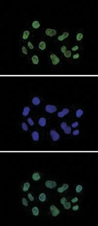 ICC/IF analysis of 4% paraformaldehyde fixed HeLa cells using GTX60815 Histone H3K27ac (Acetyl Lys27) antibody - ChIP grade.<br>Green : Primary antibody<br>Blue : DAPI<br>Dilution : 1:500