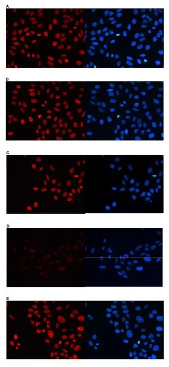 ICC/IF analysis of 4% paraformaldehyde fixed U2OS cells using GTX60819 Histone H3K4me2 (Di-methyl Lys4) antibody - ChIP grade. Staining of the cells with the H3K4me2 antibody after incubation of the antibody with 5 ng/microl blocking peptide containing the unmodified and the mono-, di- and trimethylated H3K4 (Figure B, C, D, respectively). Red : Primary antibody Blue : DAPI Dilution : 1:5000
