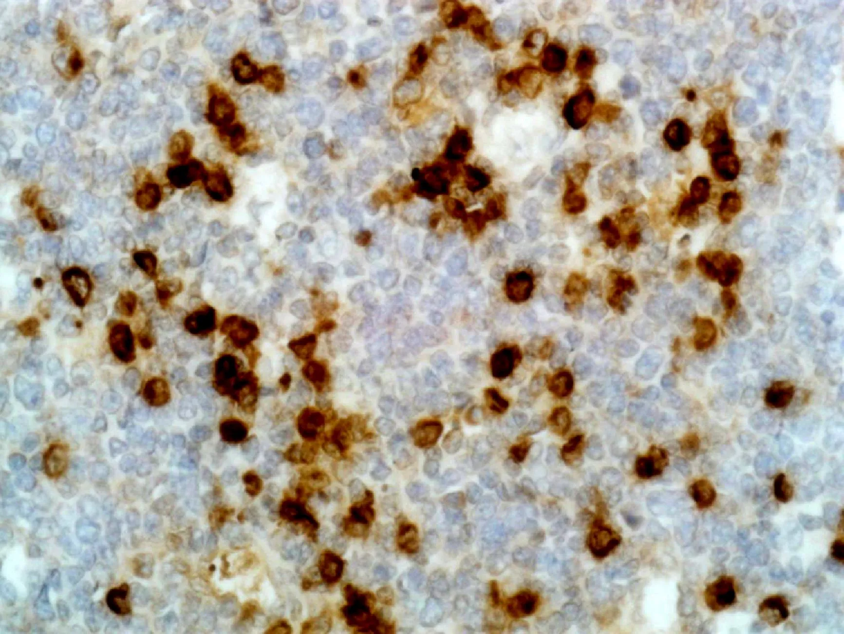 IHC-P analysis of human tonsil tissue using GTX60872 Human Lambda Light Chain antibody [RM127].