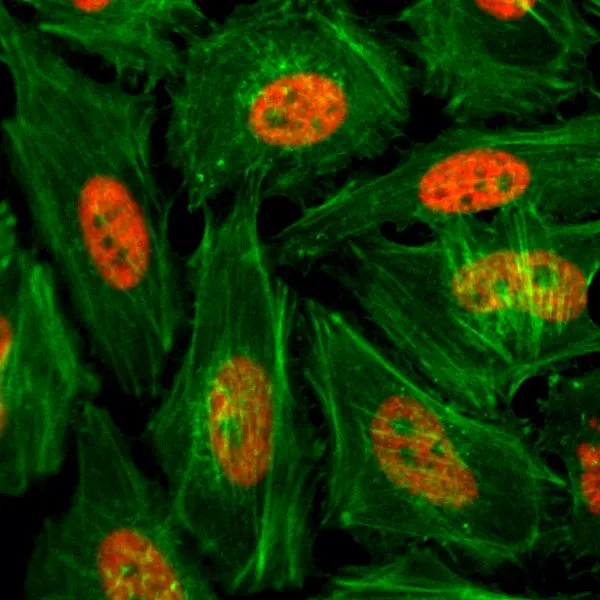 ICC/IF analysis of HeLa cells treated with sodium butyrate using GTX60878 Histone H3K4me1 (Mono-methyl Lys4) antibody [RM140]. Red : Primary antibody Green : Actin