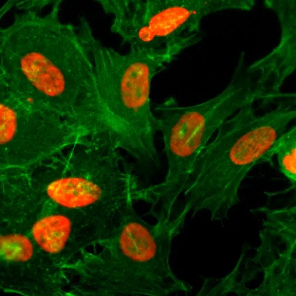 ICC/IF analysis of HeLa cells treated with sodium butyrate using GTX60881 Histone H3K36ac (Acetyl Lys36) antibody [RM154]. Red : Primary antibody Green : Actin