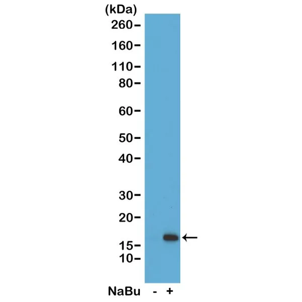 WB analysis of acid extracts from HeLa cells untreated (-) or treated with sodium butyrate (+) using GTX60881 Histone H3K36ac (Acetyl Lys36) antibody [RM154].<br>Dilution : 1?g/ml