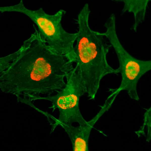 ICC/IF analysis of HeLa cells treated with sodium butyrate using GTX60883 Histone H3K79ac (Acetyl Lys79) antibody [RM156]. Red : Primary antibody Green : Actin