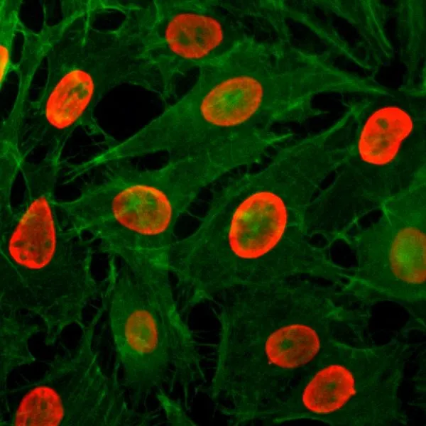 ICC/IF analysis of HeLa cells treated with sodium butyrate using GTX60885 Histone H3K9ac (Acetyl Lys9) antibody [RM161]. Red : Primary antibody Green : Actin