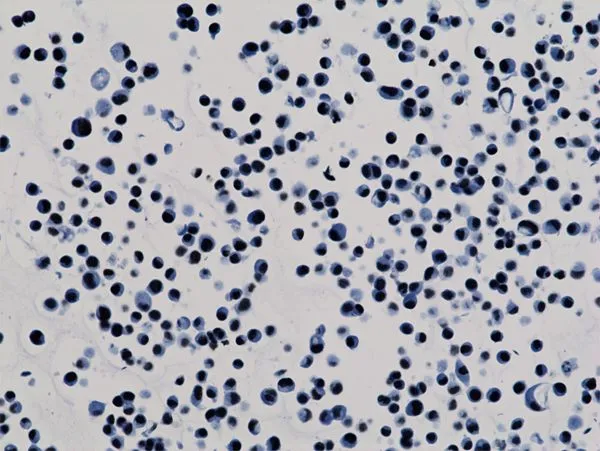 ICC/IF analysis of HepG2 cells using GTX60885 Histone H3K9ac (Acetyl Lys9) antibody [RM161].