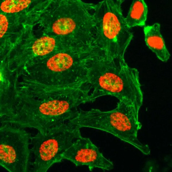 ICC/IF analysis of HeLa cells treated with sodium butyrate using GTX60886 Histone H3K18ac (Acetyl Lys18) antibody [RM166]. Red : Primary antibody Green : Actin