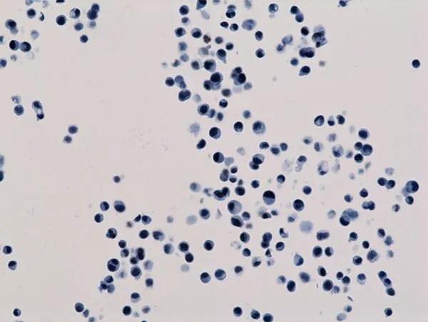 ICC/IF analysis of HepG2 cells using GTX60886 Histone H3K18ac (Acetyl Lys18) antibody [RM166].