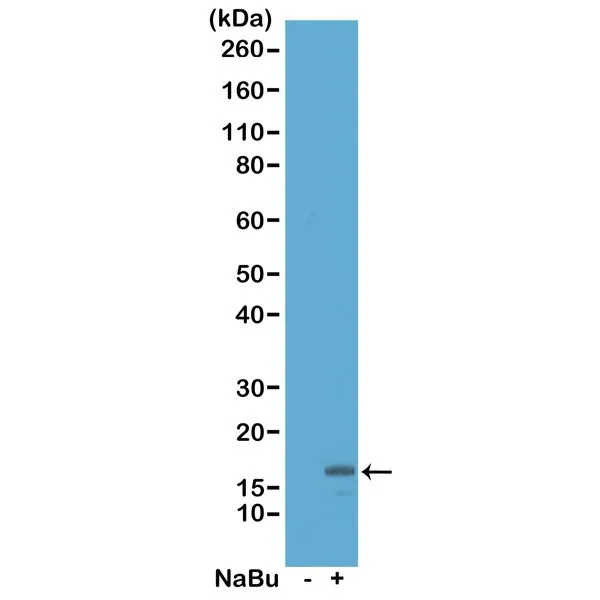 WB analysis of acid extracts from HeLa cells untreated (-) or treated with sodium butyrate (+) using GTX60886 Histone H3K18ac (Acetyl Lys18) antibody [RM166]. Dilution : 0.5microg/ml