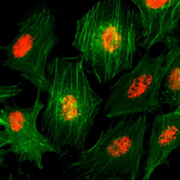 ICC/IF analysis of HeLa cells using GTX60888 Histone H3 antibody [RM188]. Red : Primary antibody Green : Actin
