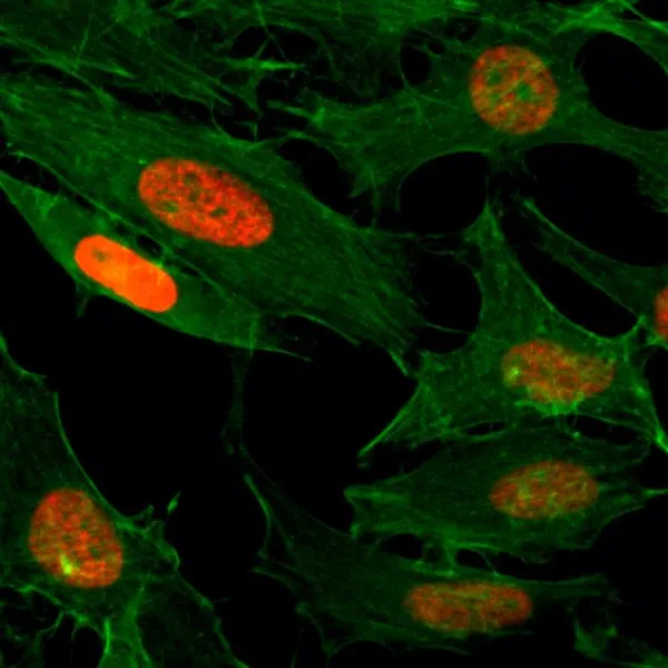 ICC/IF analysis of HeLa cells treated with sodium butyrate using GTX60893 Histone H3K4ac (Acetyl Lys4) antibody [RM149]. Red : Primary antibody Green : Actin