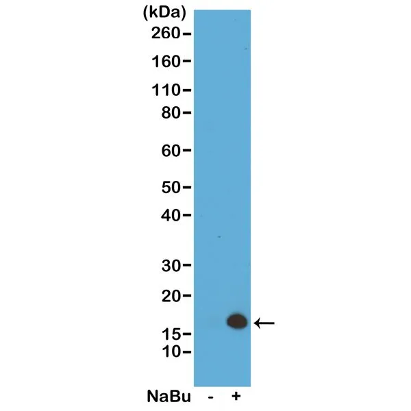 WB analysis of acid extracts from HeLa cells untreated (-) or treated with sodium butyrate (+) using GTX60893 Histone H3K4ac (Acetyl Lys4) antibody [RM149]. Dilution : 0.5microg/ml