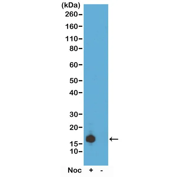 WB analysis of acid extracts of HeLa cells treated or non-treated with Nocodazole using GTX60896 Histone H3S10ph (phospho Ser10) antibody [RM163]. Dilution : 0.5microg/ml