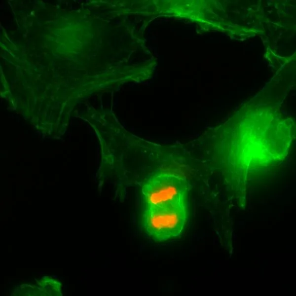 ICC/IF analysis of HeLa cells using GTX60897 Histone H3T3ph (phospho Thr3) antibody [RM159]. Red : Primary antibody Green : Actin