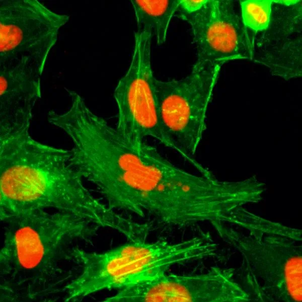 ICC/IF analysis of HeLa cells treated with sodium butyrate using GTX60904 Histone H4R3me1 (Monomethyl Arg3) antibody [RM195]. Red : Primary antibody Green : Actin