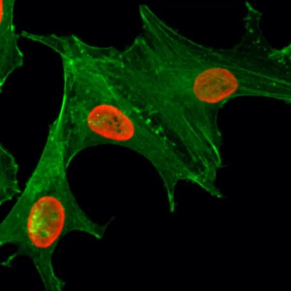 ICC/IF analysis of HeLa cells treated with sodium butyrate using GTX60905 Histone H4K5ac (Acetyl Lys5) antibody [RM199]. Red : Primary antibody Green : Actin