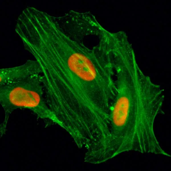 ICC/IF analysis of HeLa cells treated with sodium butyrate using GTX60906 Histone H4K8ac (Acetyl Lys8) antibody [RM201]. Red : Primary antibody Green : Actin
