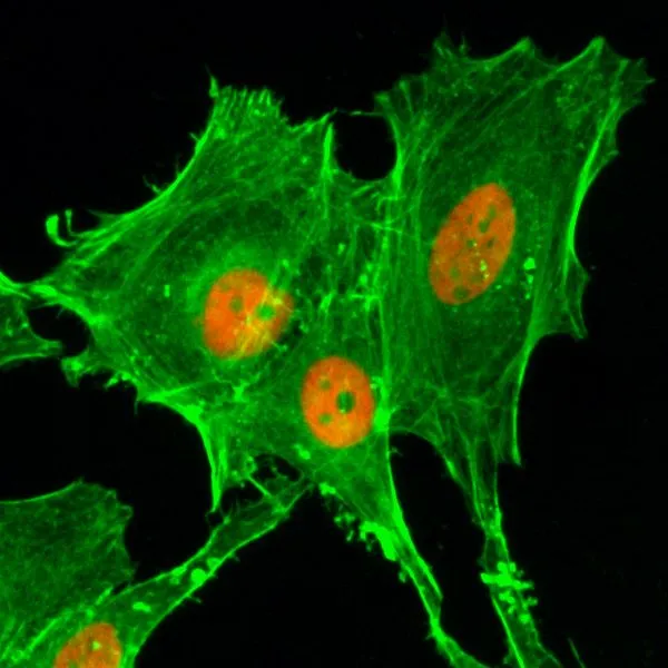 ICC/IF analysis of HeLa cells treated with sodium butyrate using GTX60908 Histone H4K20ac (Acetyl Lys20) antibody [RM205]. Red : Primary antibody Green : Actin