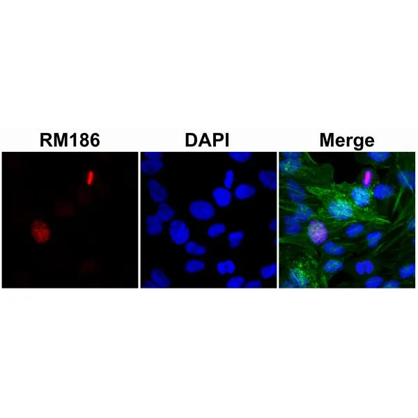 ICC/IF analysis of HeLa cells treated with sodium butyrate using GTX60910 Histone H3 antibody [RM186]. Red : Primary antibody Green : Actin