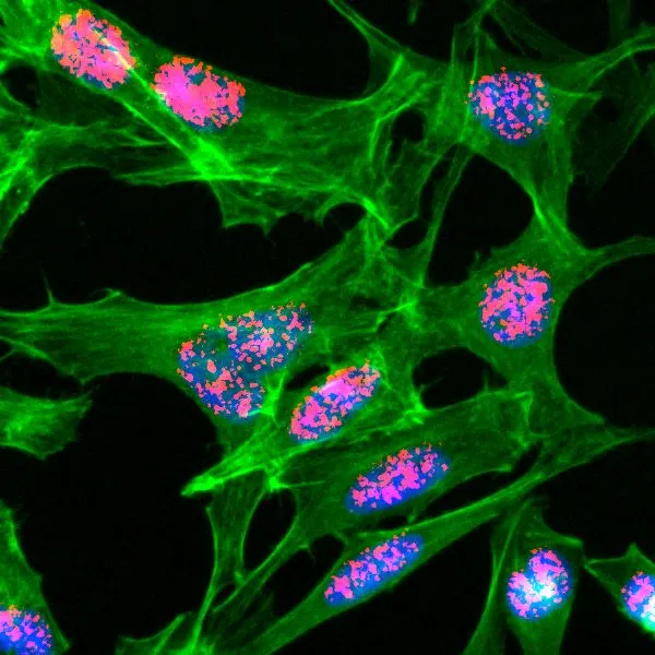ICC/IF analysis of HeLa cells treated with sodium butyrate using GTX60911 Histone H3K23ac (Aceyl Lys23) antibody [RM169]. Red : Primary antibody Green : Actin
