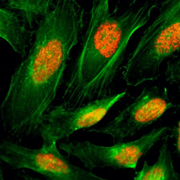 ICC/IF analysis of HeLa cells using GTX60913 Histone H4 antibody [RM212]. Red : Primary antibody Green : Actin
