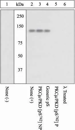 WB (peptide competition) analysis of K562 cells stimulated with PMA (2-6) using GTX60928 PKC mu (phospho Ser742) antibody prior incubated with the non-phosphopeptide corresponding to the immunogen (Lane 3), a generic phosphoserine-containing peptide (4), or, the phosphopeptide immunogen (Lane 5) control. The data show that only the immunogen phosphopeptide blocks the signal, demonstrating the specificity of the antibody. The membrane treated with phosphatase (Lane 6) eliminates the signal further verifying that the antibody is phospho-specific. WB (peptide competition) analysis of K562 cells stimulated with PMA (2-6) using GTX60928 PKC mu (phospho Ser742) antibody prior incubated with the non-phosphopeptide corresponding to the immunogen (Lane 3), a generic phosphoserine-containing peptide (4), or, the phosphopeptide immunogen (Lane 5) control. The data show that only the immunogen phosphopeptide blocks the signal, demonstrating the specificity of the antibody. The membrane treated with phosphatase (Lane 6) eliminates the signal further verifying that the antibody is phospho-specific.