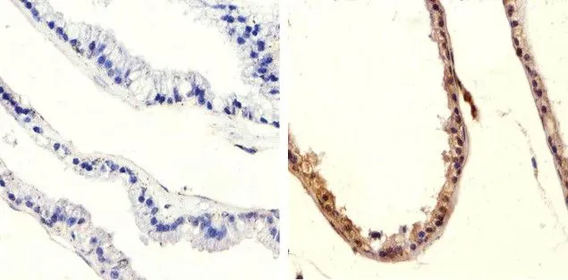 IHC-P analysis of mouse prostate tissue using GTX60929 PTEN (phospho Ser370) antibody. Right : Primary antibody Left : Negative control without primary antibody Antigen retrieval : 10mM sodium citrate (pH 6.0), microwaved for 8-15 min Dilution : 1:20