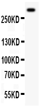 WB analysis of 50ug mouse lung tissue lysate using GTX60934 VWF antibody. Dilution : 0.5 microg/mL