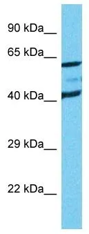 WB analysis of Jurkat cells using GTX SLC19A1 antibody at 1.0microg/ml.