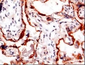 Staining is restricted to the syncytiotrophoblast of the chorionic villi in frozen human placenta tissue, stained with GTX60974. Staining is restricted to the syncytiotrophoblast of the chorionic villi in frozen human placenta tissue, stained with GTX60974.