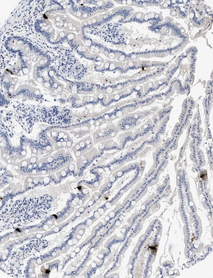 Paraffin-embedded human small intestine tissue immunostained with GTX60975