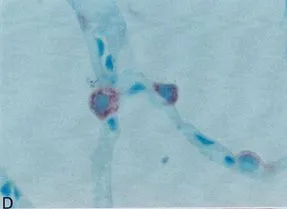 Paraffin-embedded sections of human lung immunostained with GTX60978 Paraffin-embedded sections of human lung immunostained with GTX60978