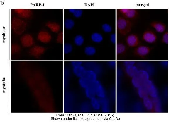 The data was published in the journal PLoS One in 2015. PMID: 26218895 The data was published in the journal PLoS One in 2015. PMID: 26218895