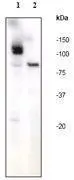 A. Western blot analysis of (1) Jurkat cells and (2) Jurkat + Staurosporine using anti-PARP-1 (p116/p85) RabMAb (catalog #GTX61031) 1:1000 dilution.