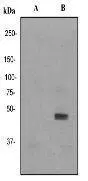 A. Western blot analysis on Hek293 cell lysates using anti-JNK3 Phospho (pS223) RabMAb (cat. #GTX61742) 1:20000 dilution. Cells were either (A) untreated (B) treated with UV. A. Western blot analysis on Hek293 cell lysates using anti-JNK3 Phospho (pS223) RabMAb (cat. #GTX61742) 1:20000 dilution. Cells were either (A) untreated (B) treated with UV.
