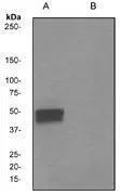 A. Western blot analysis on SH-SY5Y cell lysates using anti-Phospho-Tau (pS198) RabMAb (cat. #GTX62137) 1:100000 dilution. Cells were either (A) untreated (B) treated with AP.