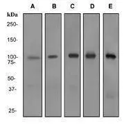Western blot analysis on (A) Human Lymph node (B) Fetal brain (C) human spleen (D) Jurkat and (E) HL-60 + retinoic acid cell lysates using anti-RIAM RabMAb (cat. #GTX62255).