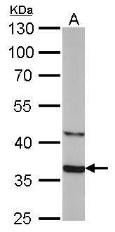 Sox2 antibodies detects Sox2 proteins on embryonic mouse brain by immunohistochemical analysis.