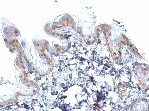 SOX2 antibody [GT1352] detects SOX2 protein at nucleus on by immunohistochemical analysis. Sample: Paraffin-embedded mouse skin. SOX2 antibody [GT1352] (GTX627405) dilution: 1:500. 
 Antigen Retrieval: Trilogy? (EDTA based, pH 8.0) buffer, 15min
