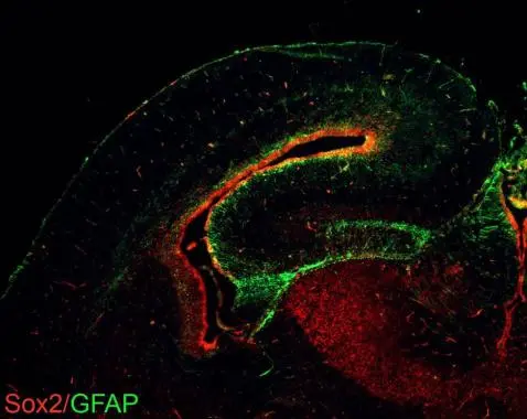 Sox2 antibodies detects Sox2 proteins on embryonic mouse brain by immunohistochemical analysis. Sample: Frozen section of embryonic mouse brain (mE18.5). Green: GFAP antibody (GTX108711) diluted at 1:1000. Red: Sox2 antibody [GT1352] (GTX627405) diluted at 1:250.