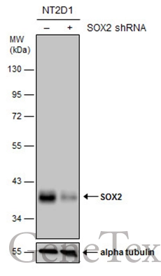 Non-transfected (–) and transfected (+) NT2D1 whole cell extracts (30 μg) were separated by 10% SDS-PAGE, and the membrane was blotted with SOX2 antibody [GT1352] (GTX627405) diluted at 1:500. The HRP-conjugated anti-mouse IgG antibody (GTX213111-01) was used to detect the primary antibody.