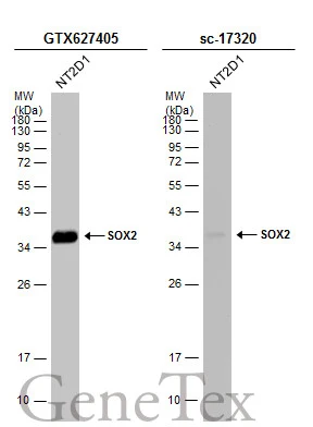 Whole cell extract (30 μg) was separated by 12% SDS-PAGE, and the membranes were blotted with SOX2 antibody [GT1352] (GTX627405) diluted at 1:1000 and competitor's antibody (sc-17320) diluted at 1:500. The HRP-conjugated anti-mouse IgG antibody (GTX213111-01) was used to detect the primary antibody, and the signal was developed with Trident ECL plus-Enhanced. *The competitor is not affiliated with GeneTex and does not endorse this product.