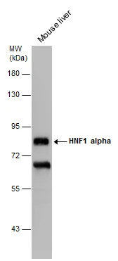 Mouse tissue extract (50 ug) was separated by 7.5% SDS-PAGE,and the membrane was blotted with HNF1 alpha antibody [GT4110] (GTX628240) diluted at 1:2000.