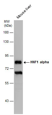 Mouse tissue extract (50 μg) was separated by 7.5% SDS-PAGE, and the membrane was blotted with HNF1 alpha antibody [GT4110] (GTX628240) diluted at 1:2000. The HRP-conjugated anti-mouse IgG antibody (GTX213111-01) was used to detect the primary antibody, and the signal was developed with Trident ECL plus-Enhanced.
