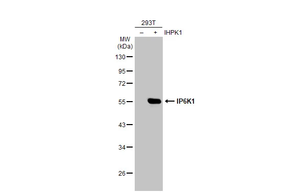 Non-transfected (–) and transfected (+) 293T whole cell extracts (30 μg) were separated by 10% SDS-PAGE, and the membrane was blotted with IP6K1 antibody [GT10611] (GTX628258) diluted at 1:20000. The HRP-conjugated anti-mouse IgG antibody (GTX213111-01) was used to detect the primary antibody.