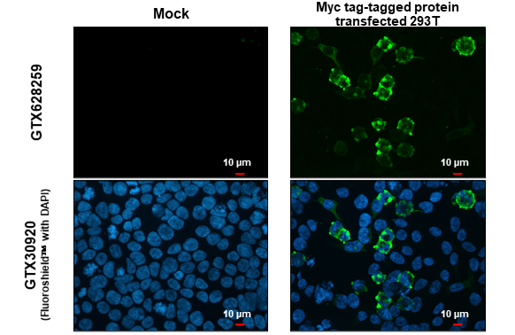 Anti-Myc tag antibody [GT0002] (GTX628259) | GeneTex