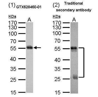 Mouse anti-Rat heavy chain antibody Comparison of western blot analysis with mouse anti-Rat heavy chain antibody (GTX628460-01 diluted at 1:5000) (1) and traditional secondary antibody (GTX224125-01 diluted at 1:5000) (2). A. 2 ug denature rat IgG