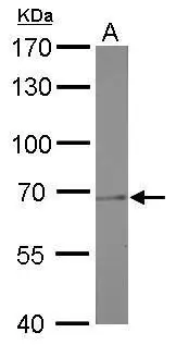 PRMT5 antibody [GT3610] detects PRMT5 protein by western blot analysis. A. 50 μg rat kidney lysate/extract 7.5% SDS-PAGE PRMT5 antibody [GT3610] (GTX628488) dilution: 1:1000 The HRP-conjugated anti-mouse IgG antibody (GTX213111-01) was used to detect the primary antibody.